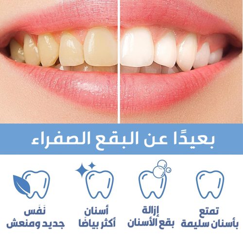 Teeth-whitening-pen-PAGE-2AR-r2rm3q5dtt53e01fjmxwyrf1nuwh3iwfphlgqlirgo