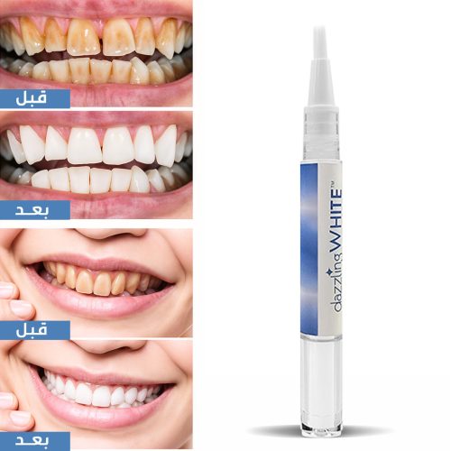 Teeth-whitening-pen-PAGE-3AR-r2rm4hepc06eqoxu4gq3h2jew164aqwnh8ijnmecg8