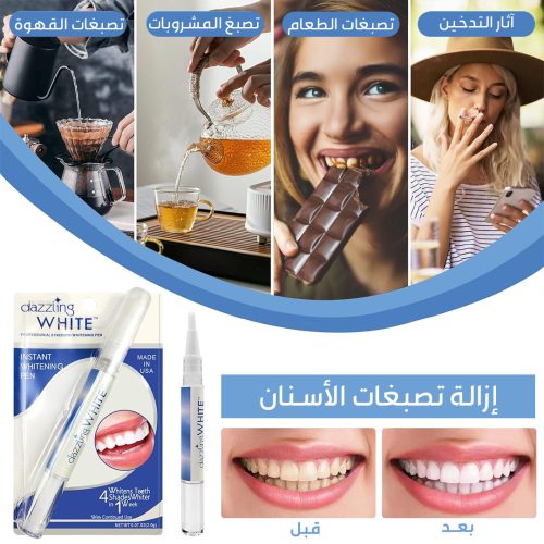 Teeth-whitening-pen-PAGE-AR-r2rm5bhjepbl27q58tq5ouy5wd1v52829de30h5qx4